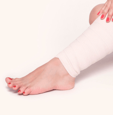 veinclinics_spiderveinsmobile_img2