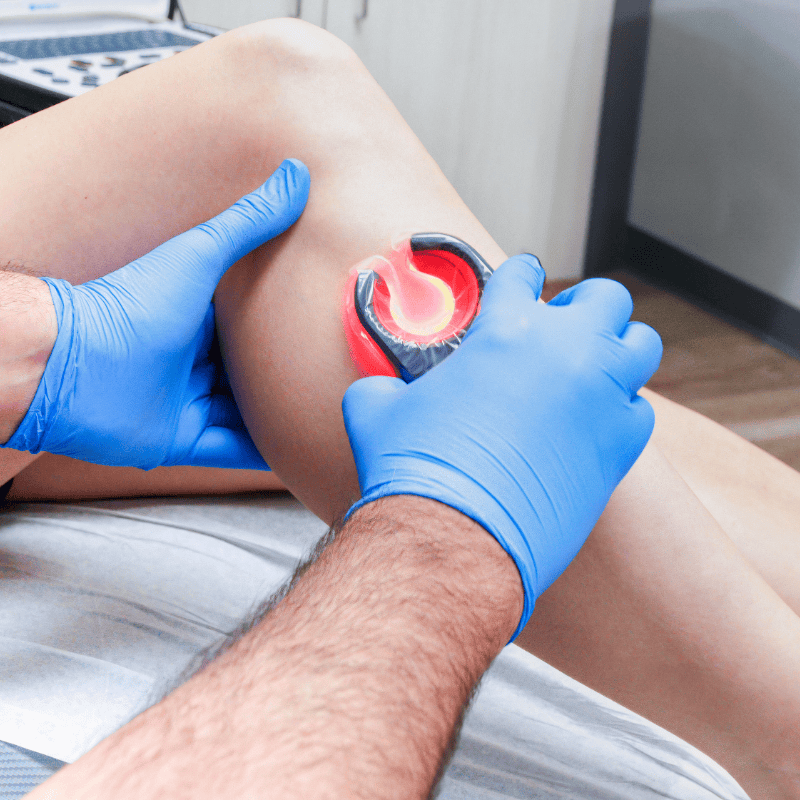 Vein Specialist in PA